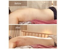 シロ(shiro)の雰囲気(背中の浮腫みがとれスッキリ◎)