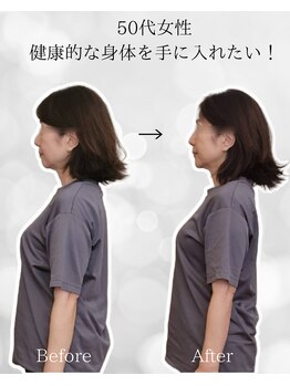 シナジェ 並木通り店(Synergye)/ジムに行くなら歪み改善必須！