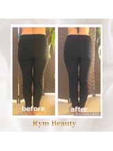 リム ビューティー(RYM BEAUTY)/最新超音波x インディバ 