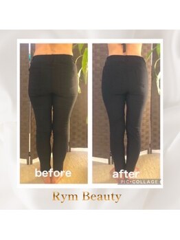 リム ビューティー(RYM BEAUTY)/最新超音波x インディバ 