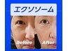 【ほうれい線・たるみケア】高濃度エクソソーム導入ツヤ肌フェイシャル¥15000