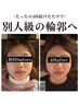 夏クーポン★人気NO.1【小顔頭蓋骨矯正+オイルケア】¥10400→¥7700