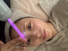 ギフト 西宮(gift)の雰囲気(高周波トリートメントで美肌ケア♪)