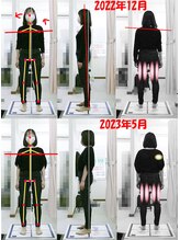 姫路なごみ整体院 なごみ鍼灸院/改善例（腰・背中首コリ・便秘）