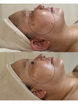 フロル(FLOR)/FLOR【根本改善専門店】