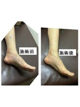 だるま整骨院/鍼灸の効果