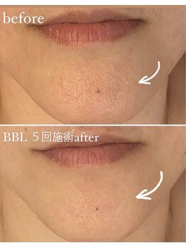 グラント ふじみ野店(grant)/