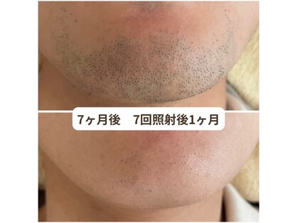 ビーボヌール(be-bonheur)の写真