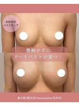 ラヴィス(RAVIS)/豊胸なしバストアップ♪