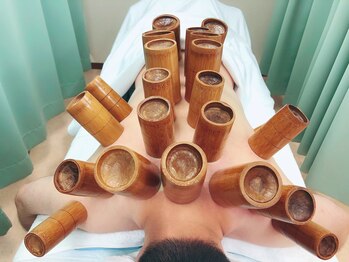 たくみ整体院/竹吸玉