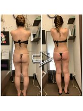 アンドユー カゴシマ(&you kagoshima)/ダイエット８回ビフォーアフター