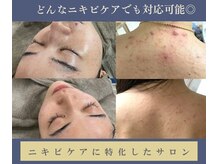 グリッター ショウナン(glitter.SHONAN)