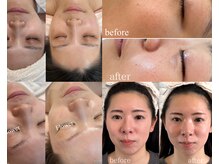 フラワー(Flower)の雰囲気（小顔リフトアップ+肌年齢+肌質改善+自分史上最高美肌へ☆）