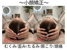 エール シガ(AILE SHIGA)/【小顔矯正】