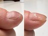 《深爪・噛み爪でお悩みの方はこちら》ケアリの美爪育成1回体験120分¥8300→
