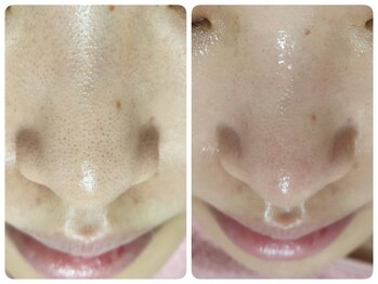 ビーグロウ(be Grow)/兵庫初☆ハイドラマシン