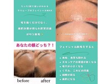 エルミタージュ(Hermitage)の雰囲気（デザイン相談◎ 1度の施術で違いを大実感。効果的施術をご案内）