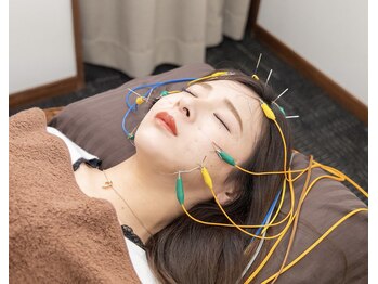 ナチュライズ(NatuRise)の写真/20代からの予防美容鍼♪若さに甘えず、もっと綺麗になりたい方へ♪