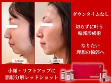 ビーズスタイル(B’S STYLE)の雰囲気(なりたい理想の輪郭に導きます♪)