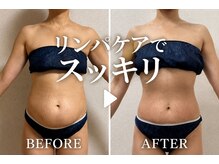 リンパケア専門サロン 銀座店/ダイエットコースのBefore/After