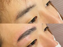 ビクシー(vixxcy)/メンズ　ビフォーアフター