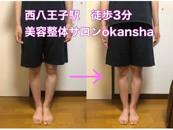 美容整体サロン オオカンシャ(okansha)/O脚Before After