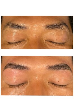 レヴィオ(REVIO)/ハリウッドブロウリフト