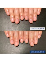 ブラン(blanc)/25.自爪育成