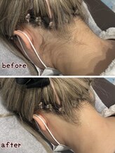 ケースタイル(k.style)/うなじbefore after