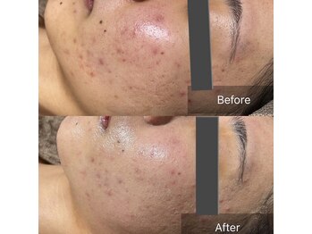 リノリー(rinory)/VOSサロンケア