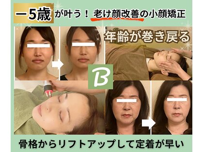 ベルソー(Berceau)の写真