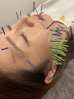 小顔になりたい