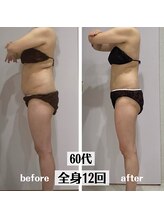 グラチア(Gratiae)/60代/脂肪撃退3ヶ月プログラム