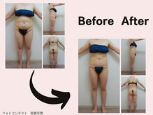 ミネルバエンダモロジー/エンダモロジー/痩身/ウェルネス