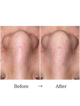 グラシア(gracia)/シミ・毛穴ケア専門店gracia