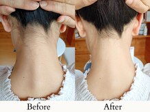 【後ろ姿の印象が変わる★うなじ脱毛】形の相談承ります♪