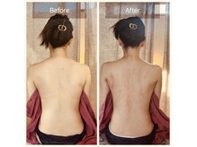 シロ(shiro)の雰囲気(施術後の赤みは2.3日で引きますのでご安心ください◎)