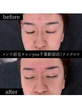 ユー 千葉駅前店(you)/ビフォ－アフター写真