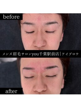 ユー 千葉駅前店(you)/ビフォ－アフター写真