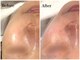 ハーシークレット(Her secret)の写真/ララピール開発者が送る【ハリ艶、透明感を叶えるダクトピール】PDRN,白玉グルタチオンなど高濃度配合