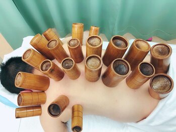 たくみ整体院/【竹吸玉】