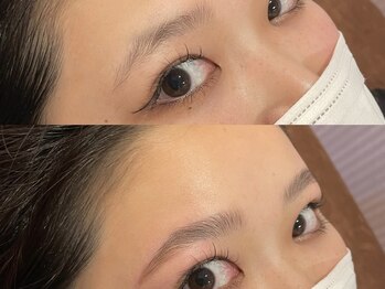 ビクシー(vixxcy)/レディース ビフォーアフター