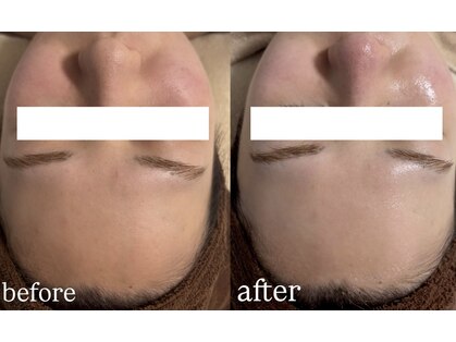 ルネ(Renee)の写真