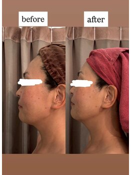 シャレール アリオ鷲宮店(Chareir)/ハイパーナイフ/before→after