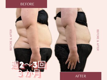 ヨサパーク モア(YOSA PARK Moa)/Before・After