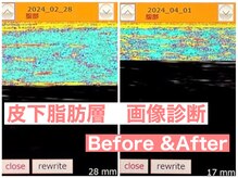 グラン ココ(GRAN COCO)の雰囲気（【BFI測定】　超音波で脂肪層測定！）