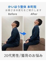 かいほう整体 本町院/猫背でつらい首に
