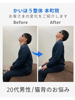 かいほう整体 本町院/猫背でつらい首に