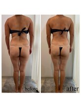 ドリームローズ(Dream Rose)/痩身