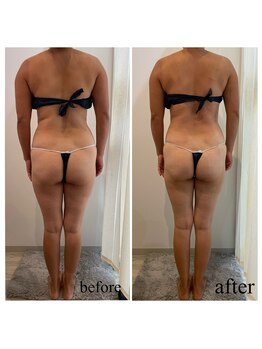 ドリームローズ(Dream Rose)/痩身